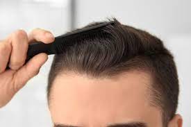 Hair Transplant