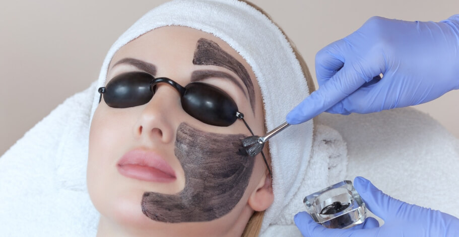 Carbon peel treatments