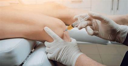 PRP Therapy