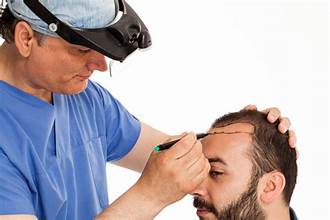 Hair Transplant